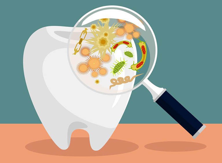 Những vấn đề răng miệng thường gặp phải và một số thông tin cần lưu ý